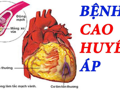 Huyết áp cao: Khi nào cần dùng thuốc và khi nào có thể kiểm soát bằng lối sống?