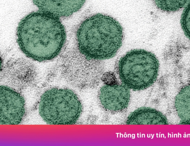 Bộ Y tế thông tin về diễn biến dịch bệnh trong nước