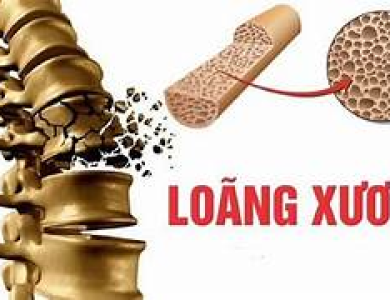 Phụ nữ tuổi nào nên phòng ngừa loãng xương?