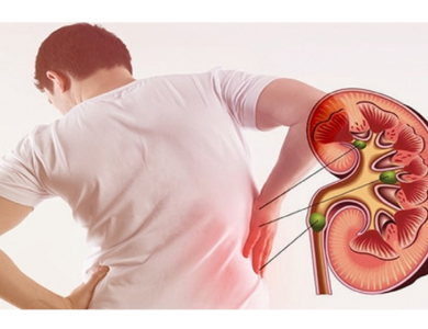 6 nguyên nhân gây sỏi thận nhiều người mắc phải