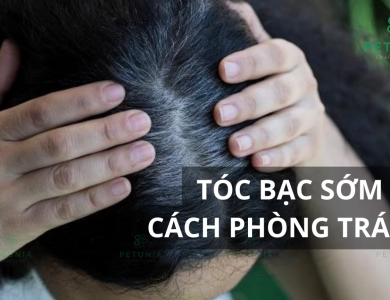 Nhiều người chưa 30 tuổi đã bạc tóc: 3 nhóm người dễ có tóc bạc nhất và 3 cách đơn giản giúp tóc đen lâu hơn