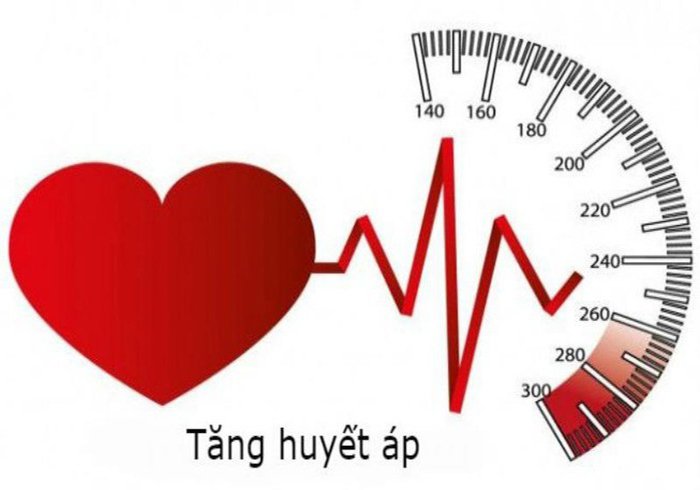 Tăng huyết áp không triệu chứng: Đừng để lỡ cơ hội sống khỏe
