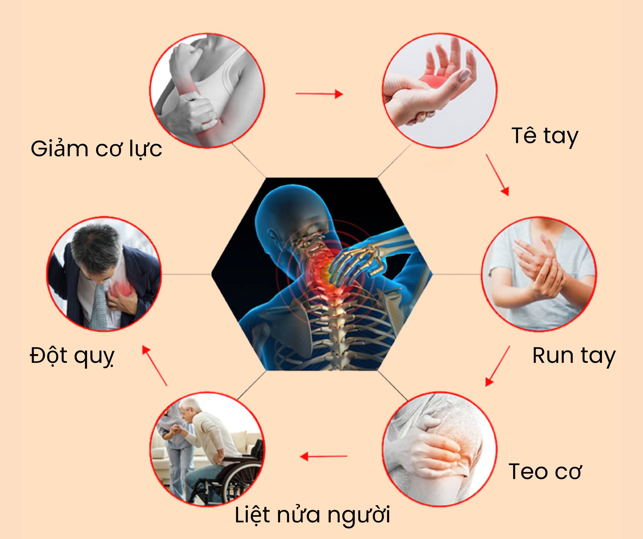 NGUYÊN NHÂN & GIẢI PHÁP TRỊ TÊ BÌ BÀN TAY, NGÓN TAY