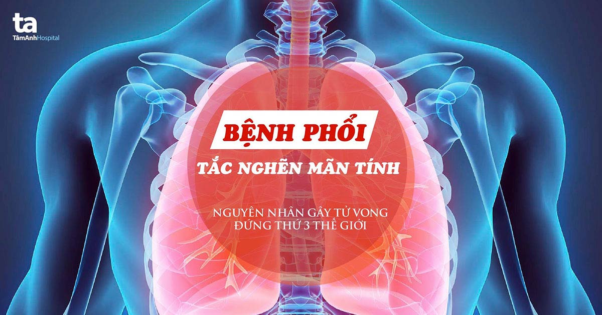 Khó thở, ho dai dẳng: Dấu hiệu sớm của bệnh gây tử vong thứ ba thế giới