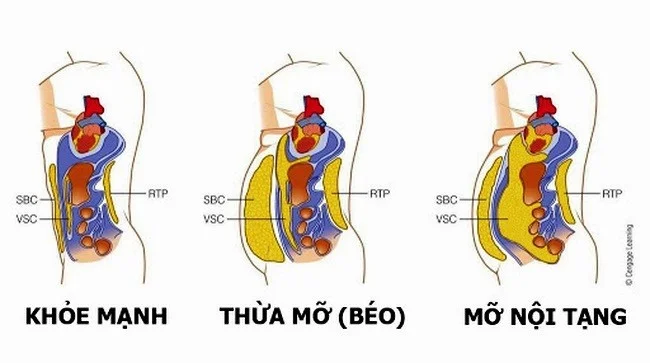 Chế Độ Ăn Dễ Nhất Giúp Loại Bỏ Mỡ Nội Tạng Nhanh Chóng (Tiến sĩ Mark Hyman)