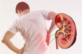 Suy thận giai đoạn đầu: vì sao thường không có triệu chứng?