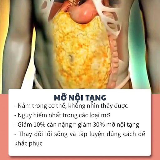 Không chỉ người béo mà cả người gầy cũng đầy… mỡ nội tạng