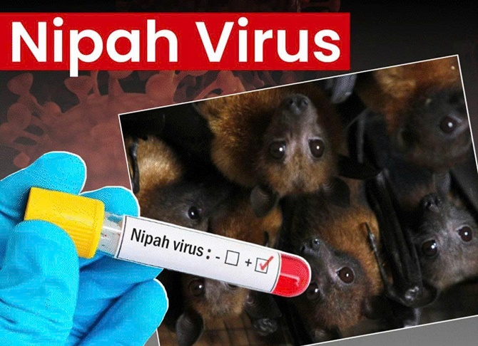 TP.HCM: Chưa ghi nhận ca Nipah tại Việt Nam, thành phố có nguy cơ thấp